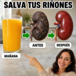 Riñones y bebidas caseras: cómo cuidarlos sin caer en promesas milagrosas