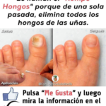 Hongos en las uñas y callos en los pies: qué funciona de verdad y qué remedios evitar