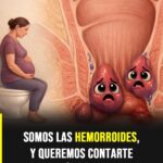Hemorroides: por qué aparecen, cómo aliviar sus síntomas y cuándo consultar