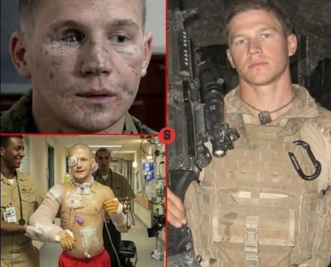 Kyle Carpenter: el marine que se lanzó hacia una granada para salvar a su compañero