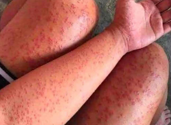 Dormir con perros o gatos: riesgos reales de pulgas, sarpullidos y cómo proteger tu salud